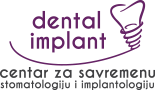 Dental Implant - Stomatološka ordinacija